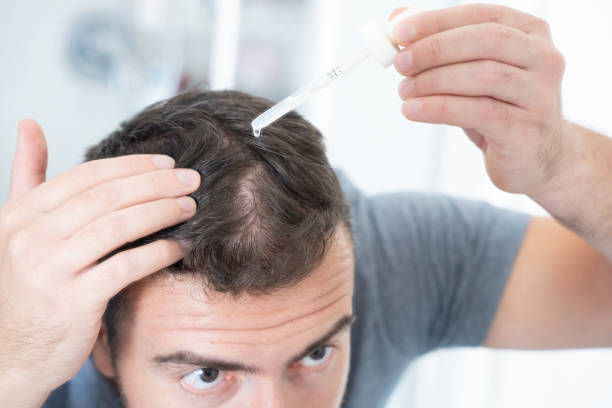 How can I deliver more minoxidil to my hair follicles?