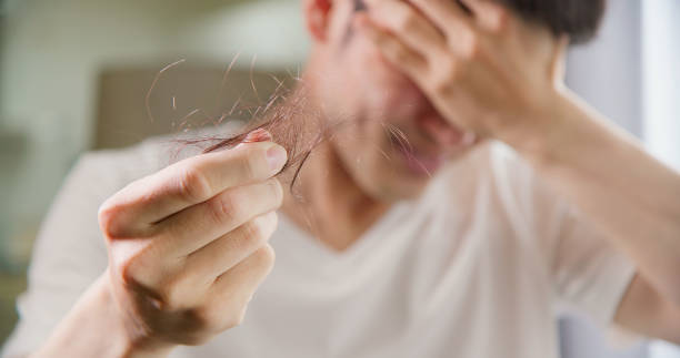 Recognizing Grieving in Patients with Advanced Hair Loss